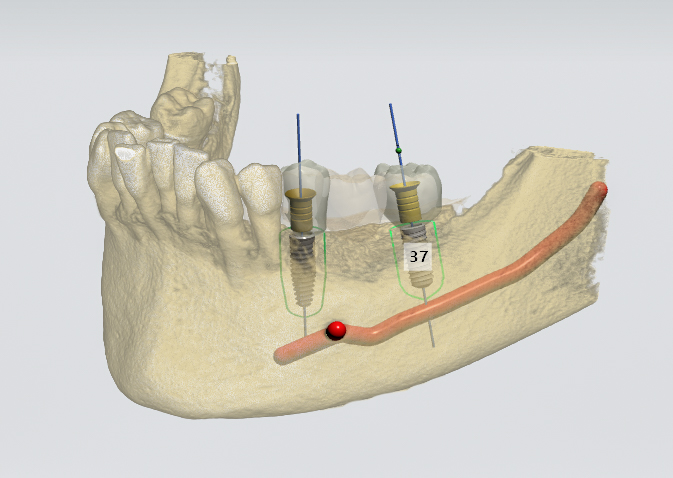 3D Model 3D Model